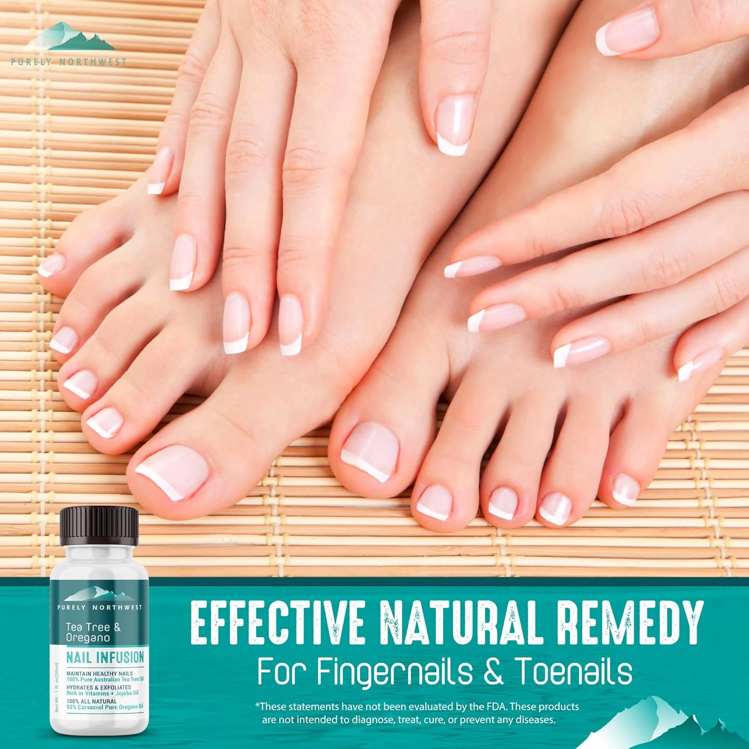 Extra Strength-Toenail Solution-100% All Natural-Tea Tree & Oregano-Effective for Thick, Discolored & Cracked Nails-Softens Dry Cracked Nails & Cuticles-by Purely Northwest 1oz