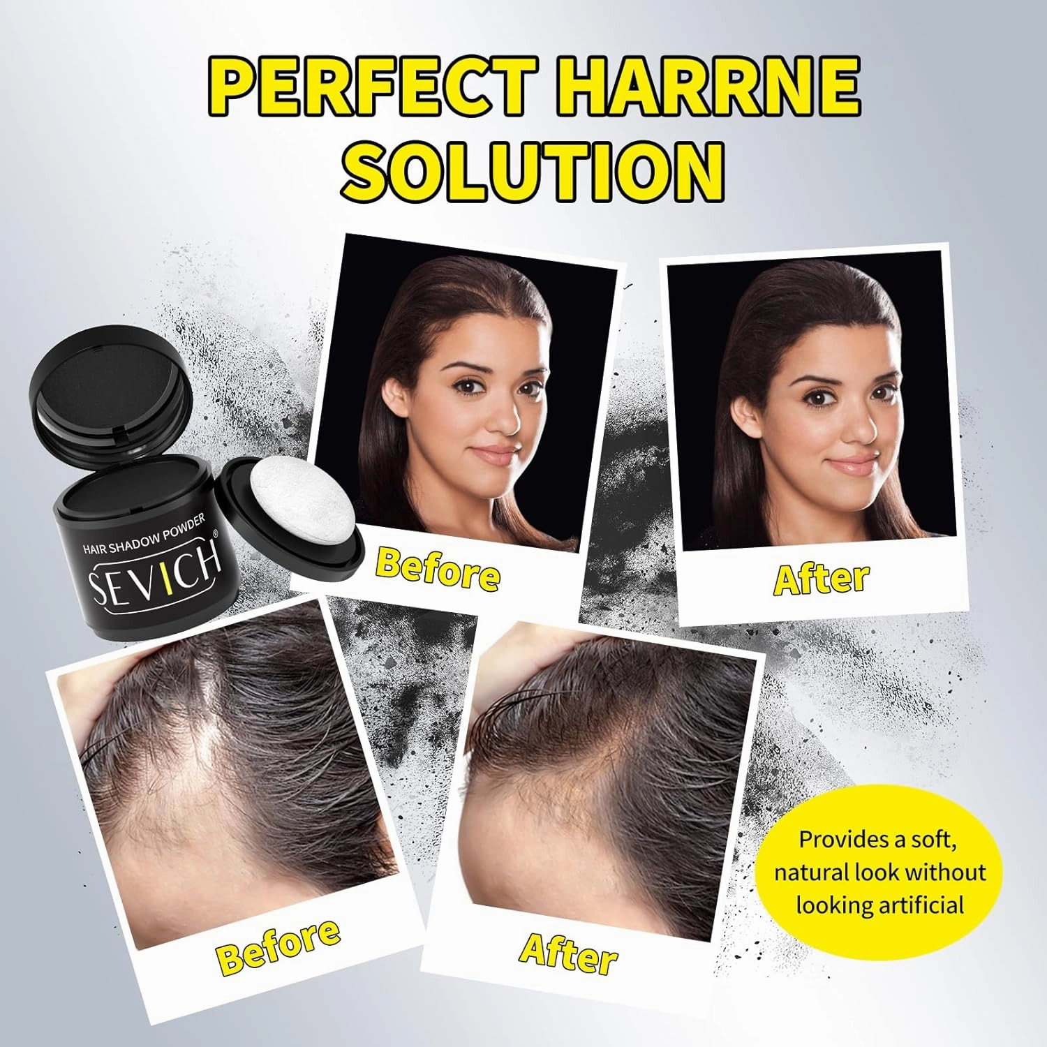 Sevich Hairline Powder 10g with Brush, Instantly Conceals Hair Loss & Thinning & Gray, 48H Waterproof Root Touch Up Powder, Natural Hair Shadow Toppers for Women & Men, 1 Box = 2.5 Boxes,Black